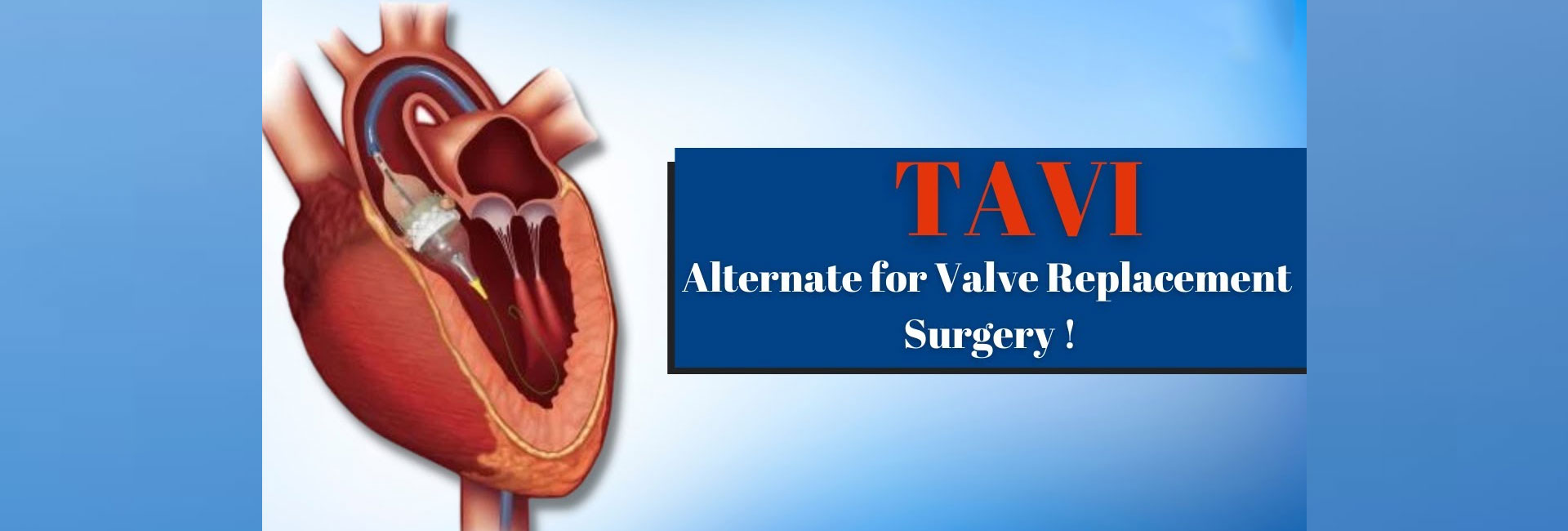 TAVI Surgery Specialist in Navi Mumbai - Dr. Mahesh Ghogare